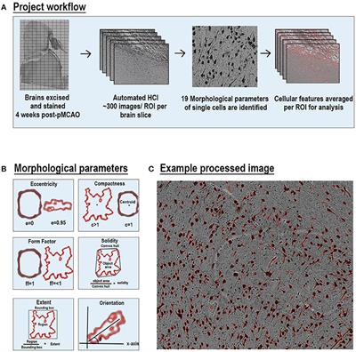 Semi-Automated Cell and Tissue Analyses Reveal Regionally Specific Morphological Alterations of Immune and Neural Cells in a Porcine Middle Cerebral Artery Occlusion Model of Stroke